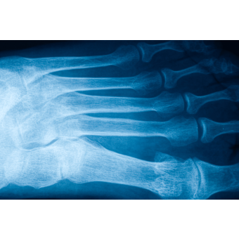 Podiatric Pharmacology and Therapeutics